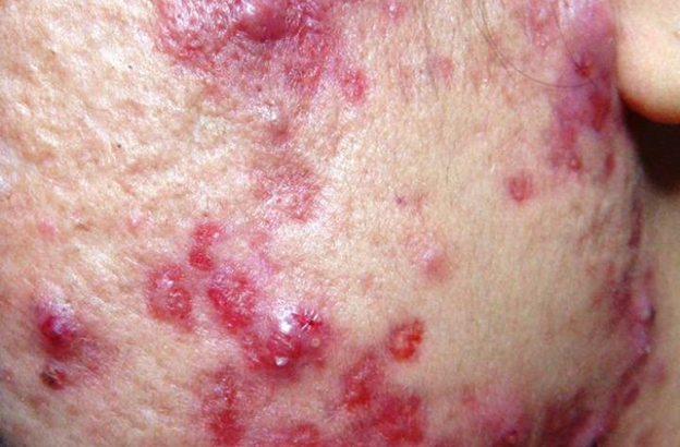 تصویر لک های پوستی خطرناک