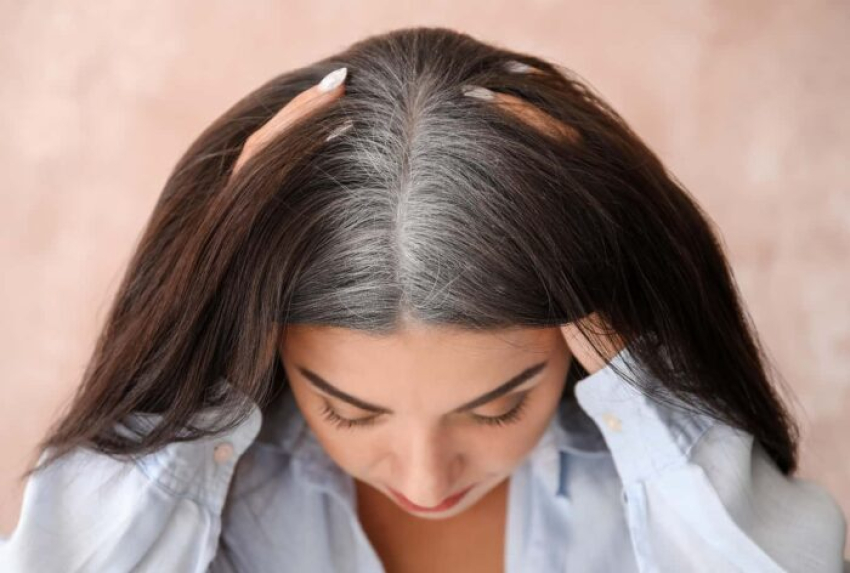 دختر جوانی که موهایش از ریشه سفید شده است